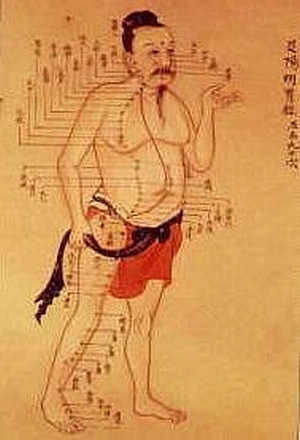 akupunktura4